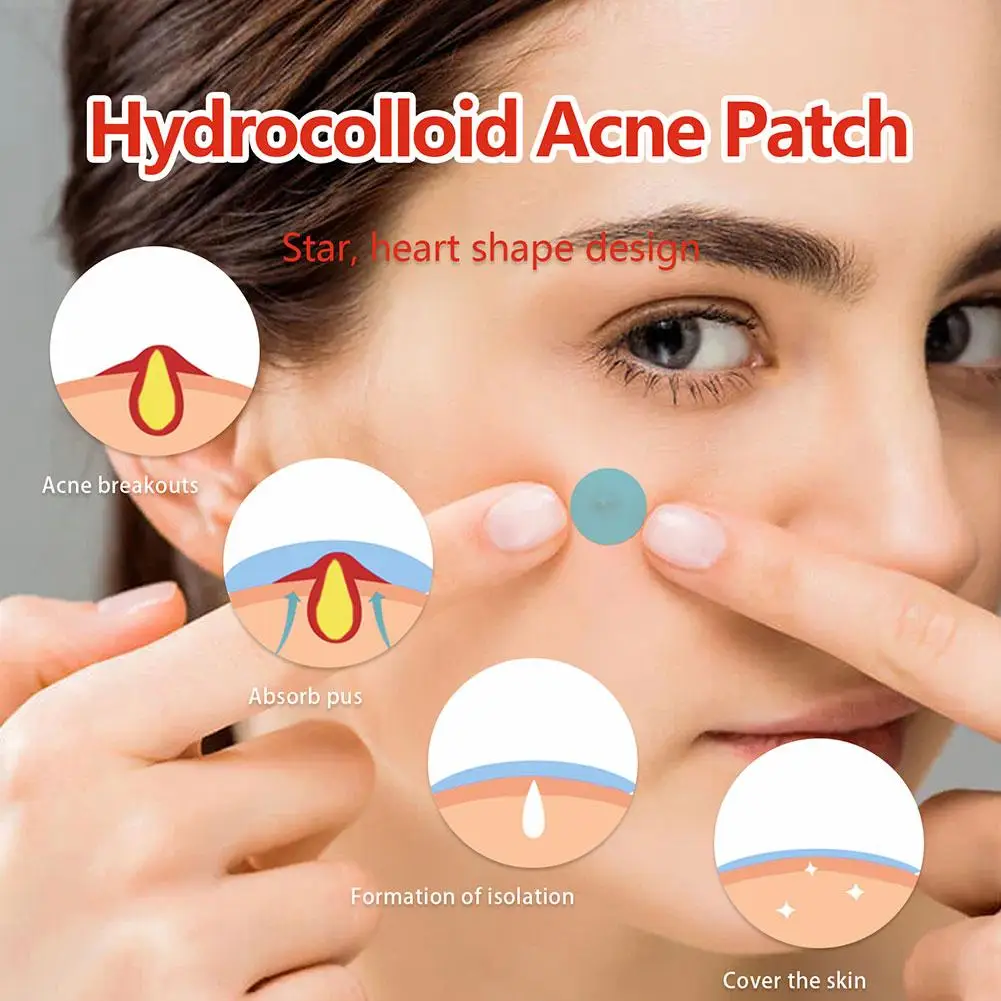 144patches Acnes Pimple Patches For Zits And Blemishes,invisible Or Colorful Spots Treatments Stickers For Face And Skin Ca I0w8