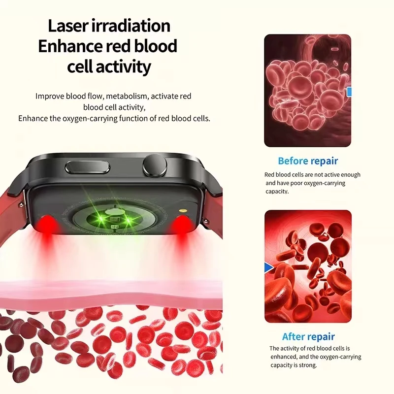 Montre intelligente multifonction E500, petite taille, température Linge, fréquence cardiaque, prise en charge de la pression artérielle, éventuelles Nings, étanche IP68, ECG laser, nouveau