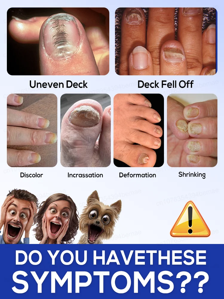 ᴴᵒᵗ ˢᵉˡˡⁱⁿᵍ ᴸᵃˢᵉʳ ᴾʳᵒᵈᵘᶜᵗ ᶠᵒʳ ᔆᵒˡᵛⁱⁿᵍ ᴺᵃⁱˡ ᴾʳᵒᵇˡᵉᵐˢ