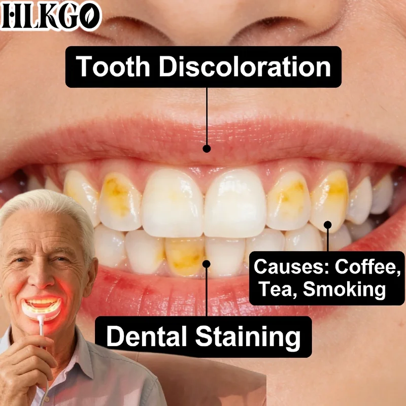 

Professional Grade Red Light Gum Treatment, Relieves Tooth Pain Sensitive Gums Dental Caries Oral Health Care