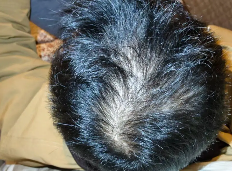 Customer review photo