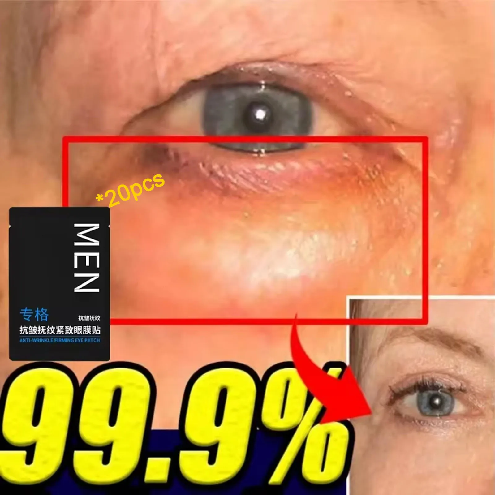 Eyes Bag Remove Collagen Eye Patch Instant Fade Fine Line Dark Circles Fat Particles Moisturizing Anti-Puffiness Korea Eye Care