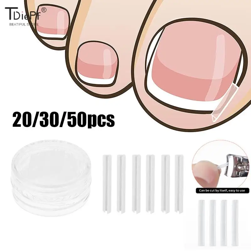 20/30/50Pc Toenail Straightening Clip Ingrown Toenail Correction Nail Treatment Elastic Patch Sticker Foot Care Pedicure Tool