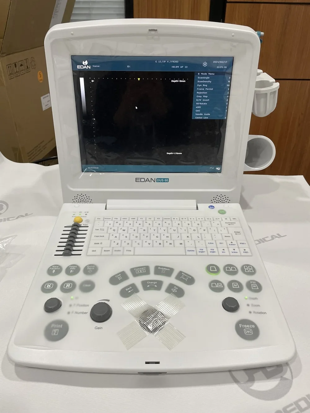 EDAN DUS 60 Ultrasound Machine for Human Black&White Ultrasound Probe Convex for Hospital Clinical Lab