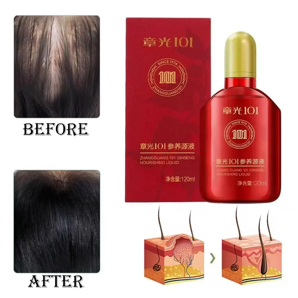 120ml Original Ginseng Hair Booster Nourishing Scalp Strong Roots Fast Growing Thickening Hair Essence Scalp Hair Care Lotion