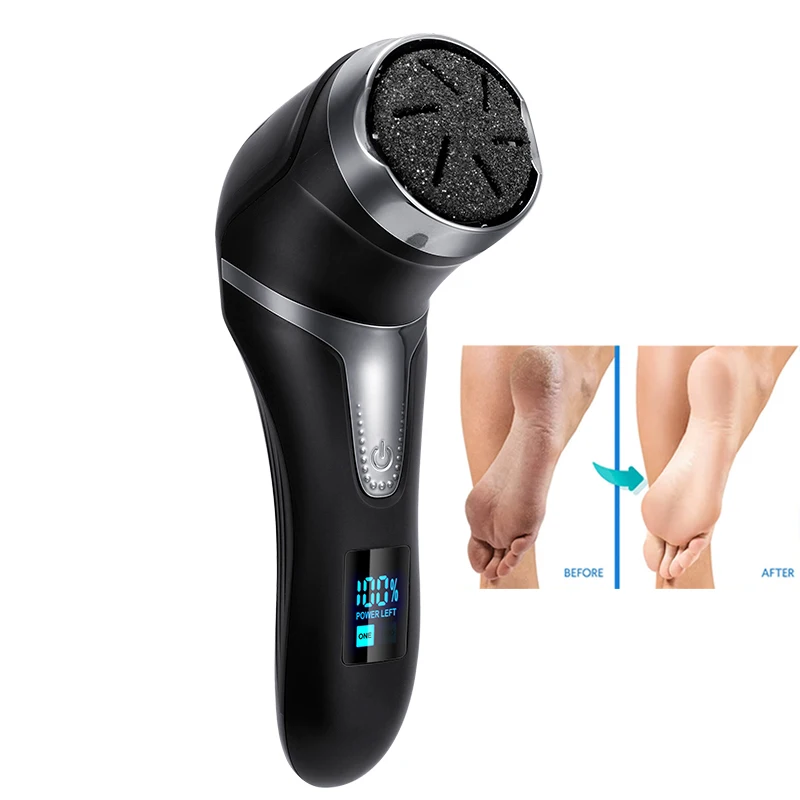 Broyeur de pieds électrique, dissolvant de callosités sous vide, outil de nettoyage de soins des pieds, Charge USB, outil d'élimination des peaux dures