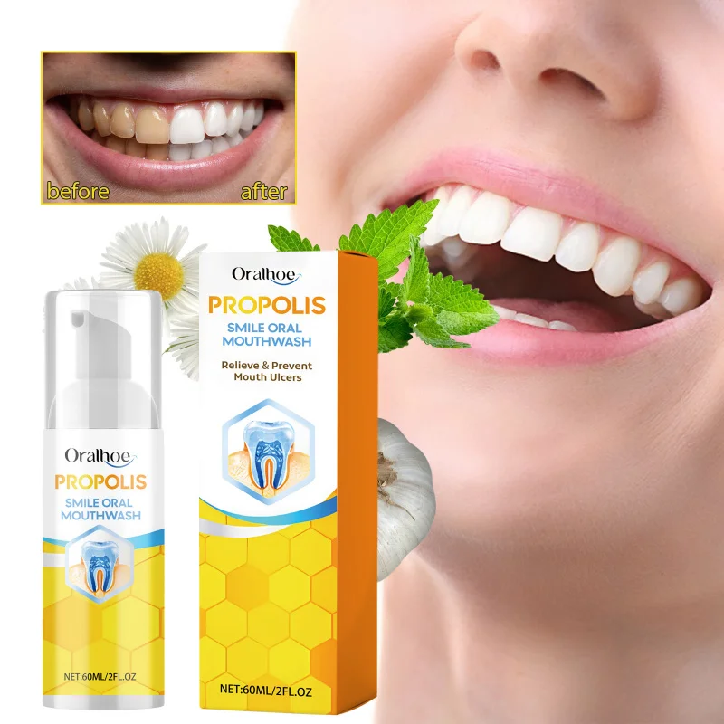 Propolis Oral Cleaning Mousse - Dental Stain Removal, Oral Care, Fresh Breath & Foam Toothpaste For Oral Hygiene