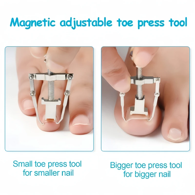 2Pcs Stainless Stee Ingrown Toenail Corrector Tool Adjustable Nail Lifter Pedicure Tool For Curved Ingrown Nails Foot Nail Care