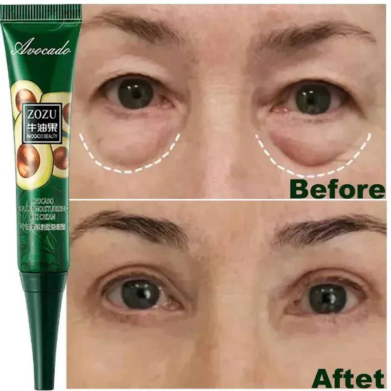 Anti Dark Circles Bags Instant Remove Wrinkles Eye Cream Puffiness Fade Eye Fine Line Tighten Whiten Under Eyes Skin Care