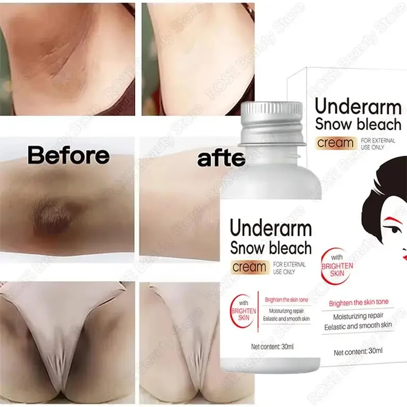 Whitening Cream Private Parts Underarm Bleaching Serum Whiten Butt Knee Brighten Inner Thigh Intimate Parts Dark Remove Melanin