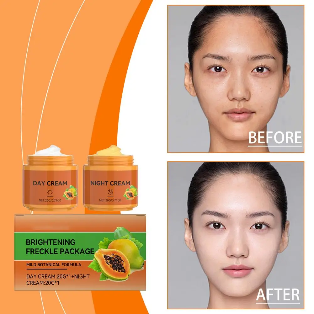 كريم تبييض البابايا يزيل النمش وتفتيح التصبغ الداكن وتنعيم البقع كريم ترطيب الوجه 40 جرام