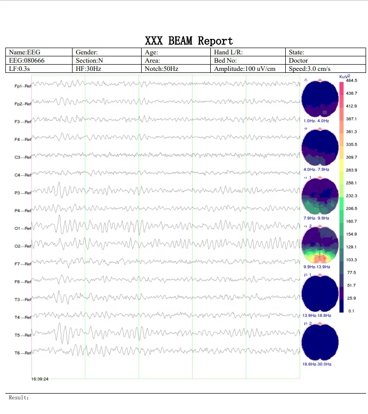 24/32/64 Channel EEG Machine/ Digital Electroencephalograph  Medical Equipment Portable