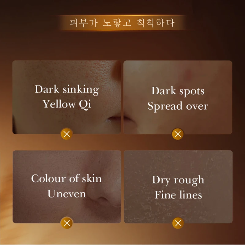 SADOER الأرز جوهر تبييض تونر الوجه ترطيب ترطيب مكافحة الشيخوخة مصل الوجه جوهر العناية بالبشرة الكورية