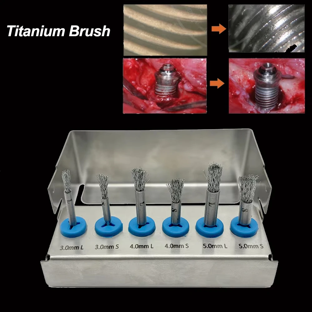 6PCS Dental High Quality Titanium Brush Debridement Peri-Implantitis Implant Surface Threads Cleaning Brush Autoclavable