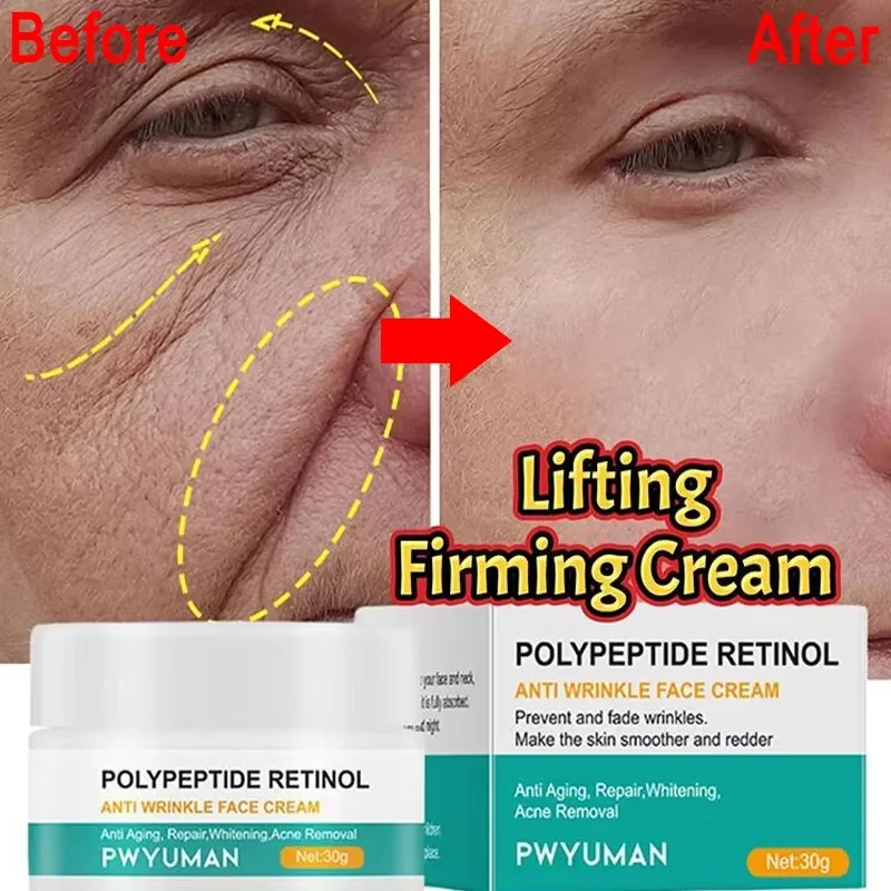 

Retinol Anti-wrinkle Cream Lifting Firming Anti-Aging Removal Face & Neck Wrinkle Efficient Moisturize Firming Korean Skin Care