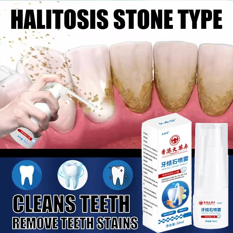 

Dental Calculus Remover Teeth Whitening Spray Toothpaste Cleaning Oral Hygiene Removal Halitosis Plaque Stain Fresh Breath Care