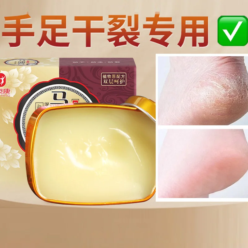 Jintai Kangma Oil Cream for Hand and Foot Cracks Moisturizing and Moisturizing Cream for Hand Cracks and Foot Cracks Skin care