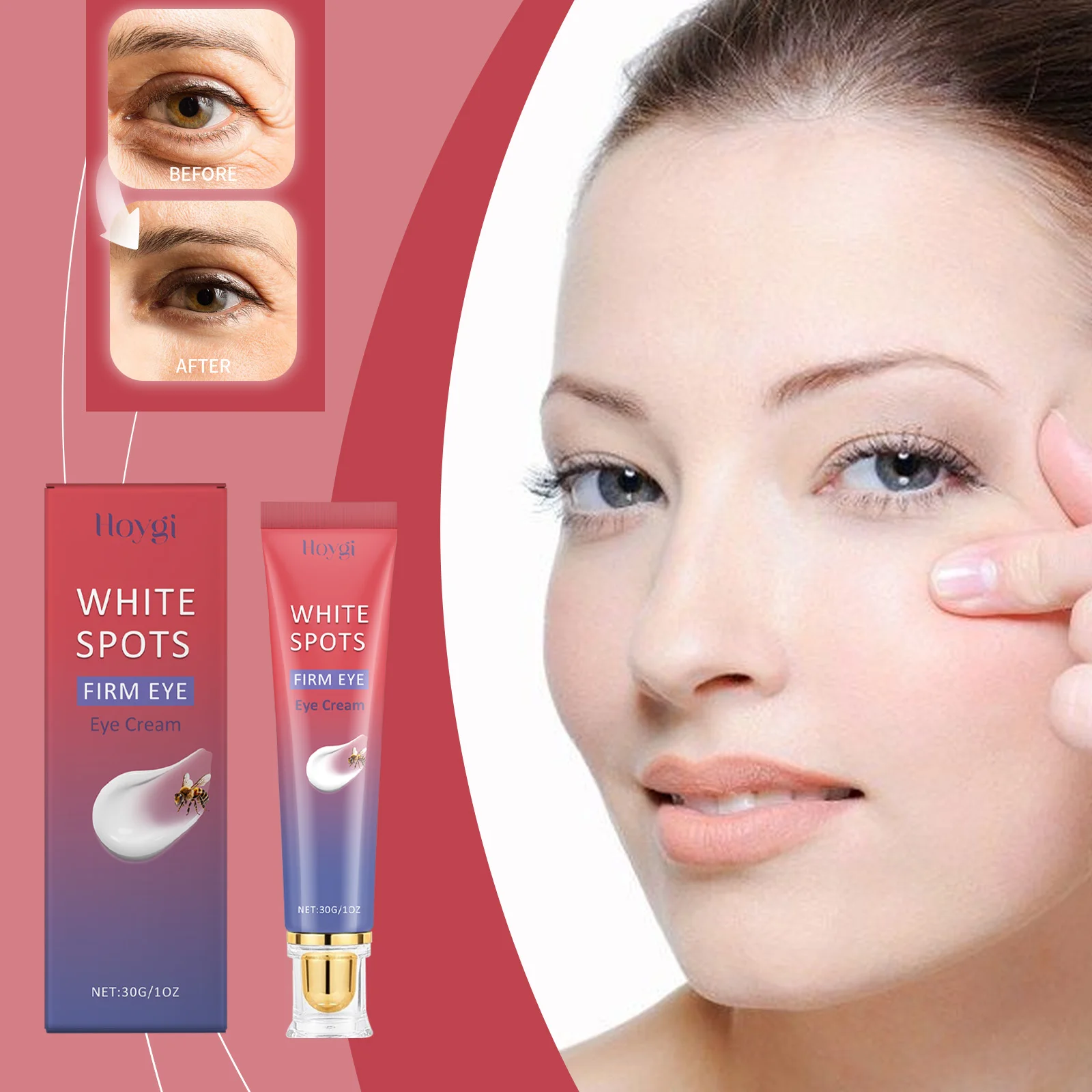 Eye Cream for White Spots & Dark Circles - Iloygi Firming Eye Treatment, Anti-Aging, Brightening, 30g