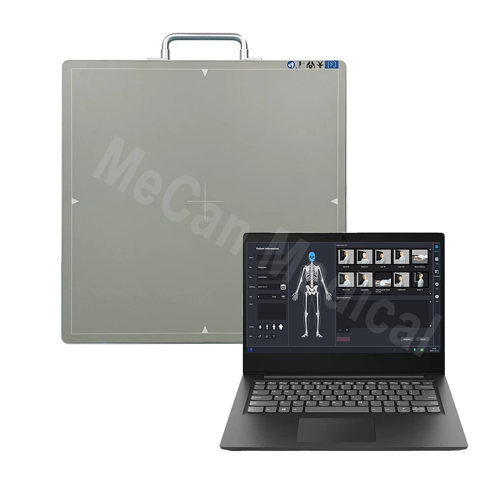 FPD 17*17'' Digital X-ray Flat Panel Detector for Veterinary and Human