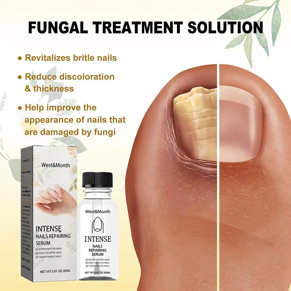 20ml Nail Fungus Treatment Essence Serum Care Serum Nails Serum Removal Anti-Infect Care Gel Fungal Cuticle Repair Hand And P8I3