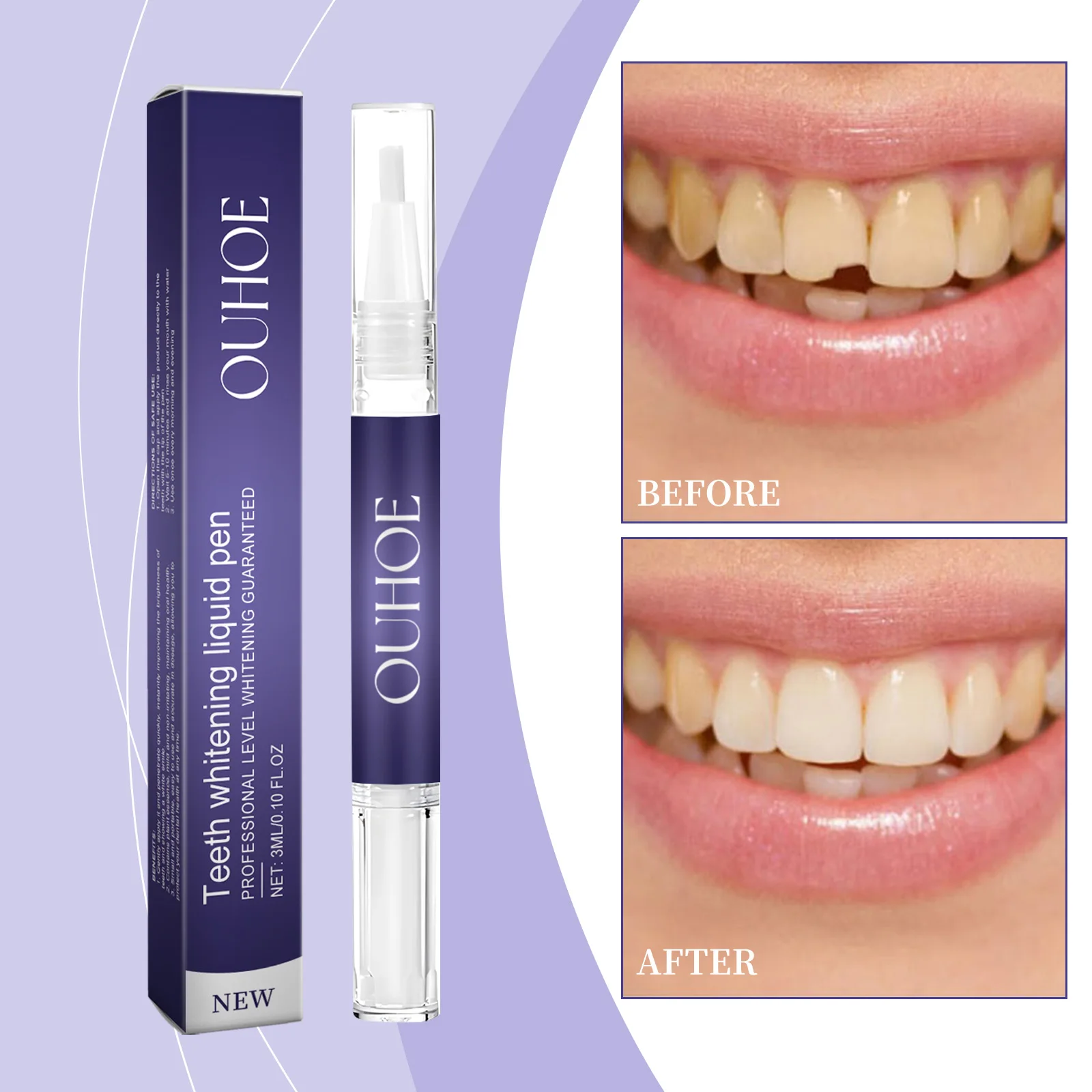 

Teeth Whitening Pen – Gentle cleaning care, removes odor, stains and yellowing, cares for teeth