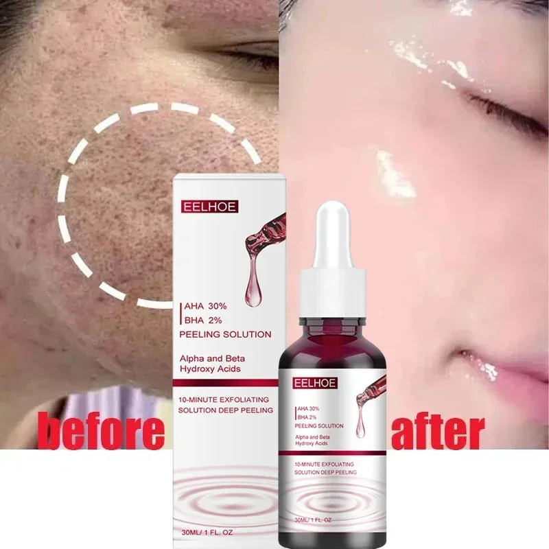 Salicylic Acid Pore Shrinking Serum Quick Elimination Large Pores Remove Blackehead Tighten Face Smooth Skin Korean Care Product