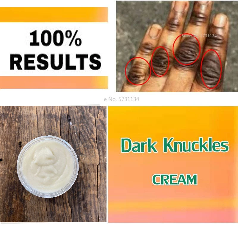 

Dark knuckles cream, Very Strong Cream , Dark Spots remover, Fast results