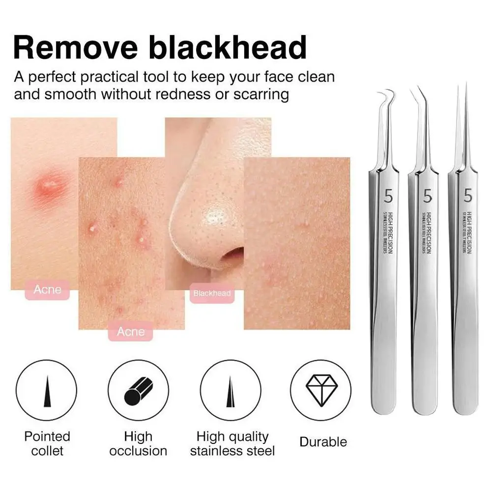 Cell Pimples Blackhead Remover Clip Ultra-fine Tweezers Needle Care Tool Facial Black Extractor Cleaner Acne Skin Dots Blac C1S0