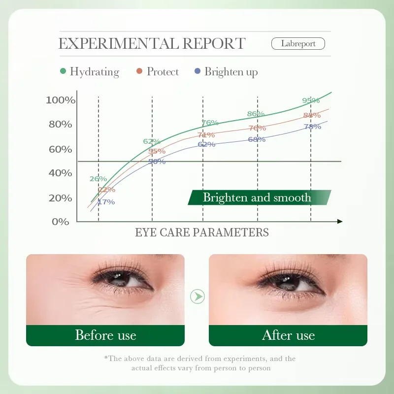 7 Days Tighten Smooth Wrinkles - đánh giá và giá Women Bags Under Eyes