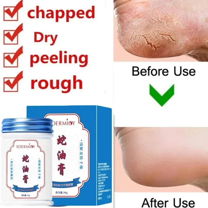 Herbal Anti Crack Foot Cream Heel Crack Repair Products Exfoliating Dead Skin Removal Softening Moisturising Smoothing Skin Care