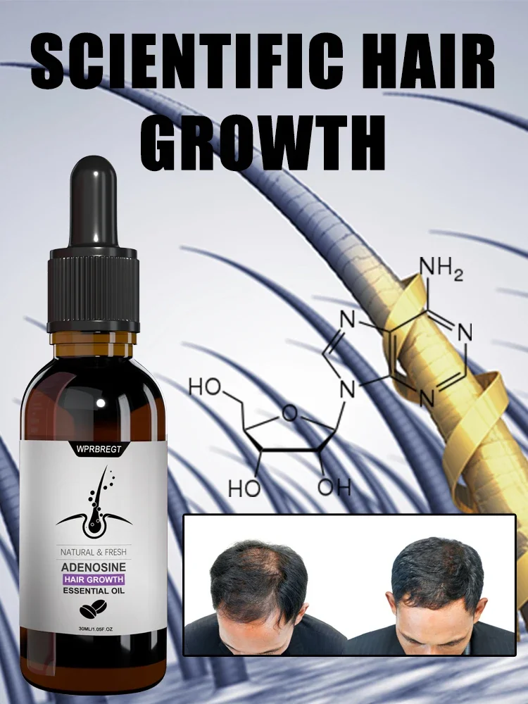 Serum pertumbuhan rambut dengan adenosine esensi solusi minyak produk pengaktif pengobatan cepat kebotakan alopecia herediter dan seboroik