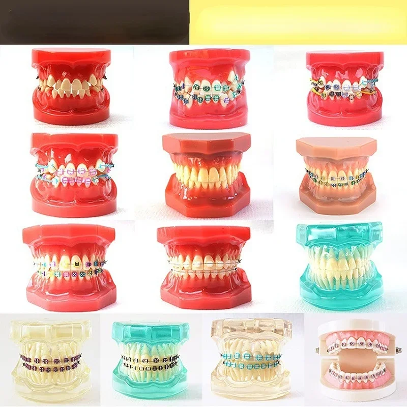 

Dental Oral Care Tooth Teeth Model Dental Orthodontic Model for Patient Communication Dentist Study Model