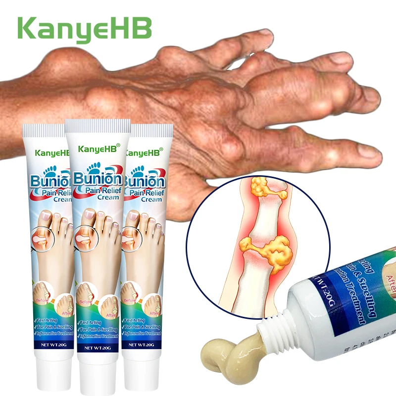 3Pcs Bunion Gout Treatment Cream Relieve Arthritis Pain Hallux Knee Lumbar Limb Stiffness Joint Valgus Corrector Ointment A990