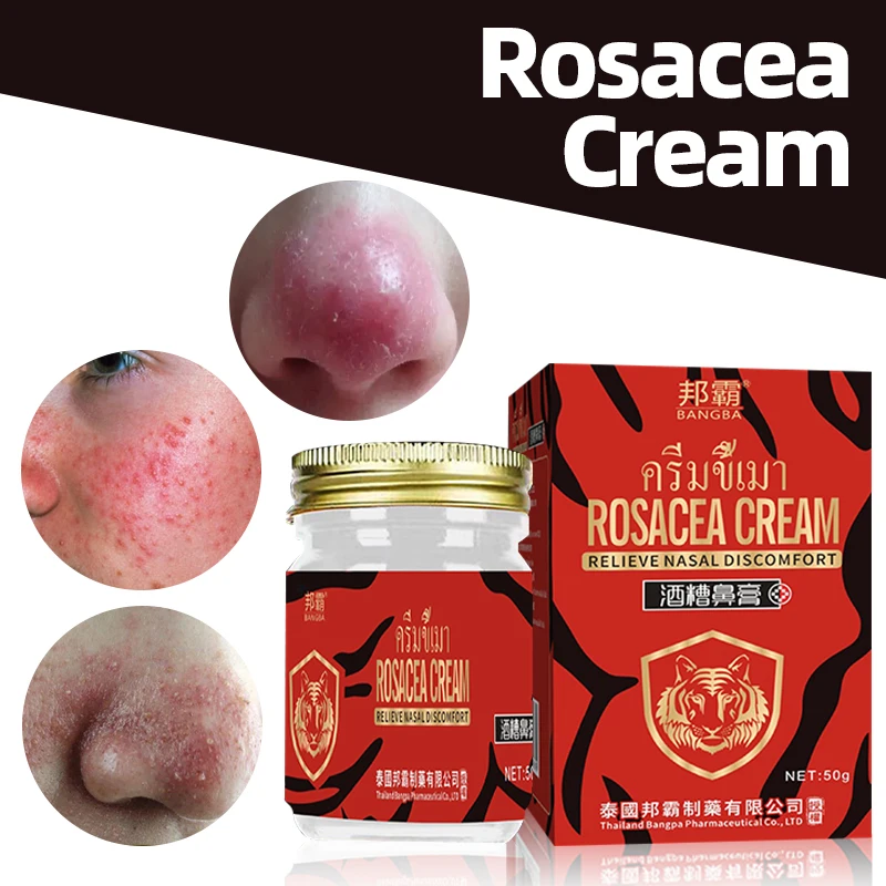 Rosacea Treatment Cream Blackhead Acne Remover Skin Care Anti Nose Mites Red Nose Repair Face Shrink Pores Thailand Formula