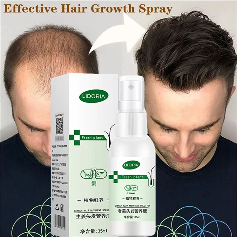 

Ginger Hair Growth Serum Spray Natural Anti Hair Loss Essence Oils Nourish Hair Roots Fast Regrowth Hair Care Products Men Women