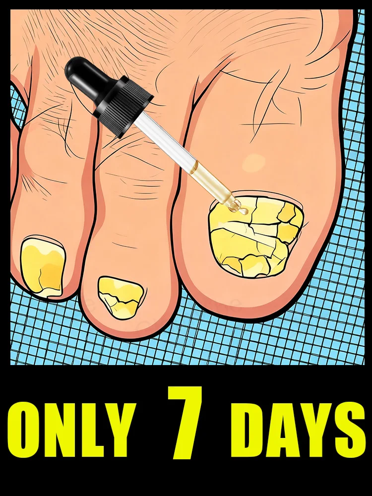 

Qᴜɪᴄᴋ Tʀᴇᴀᴛᴍᴇɴᴛ, Sᴀʏ Gᴏᴏᴅʙʏᴇ ᴛᴏ Fᴜɴɢᴀʟ Nᴀɪʟ Wᴏʀʀɪᴇs