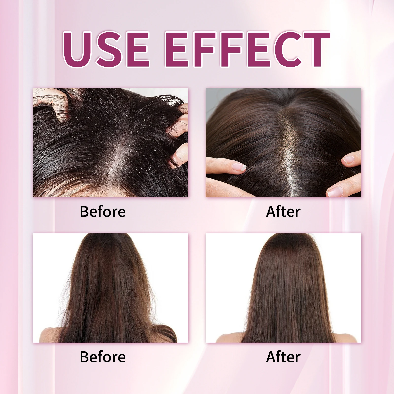 Thumbnail 3 - #57 Compare Hair Loss Treatments Before You Buy