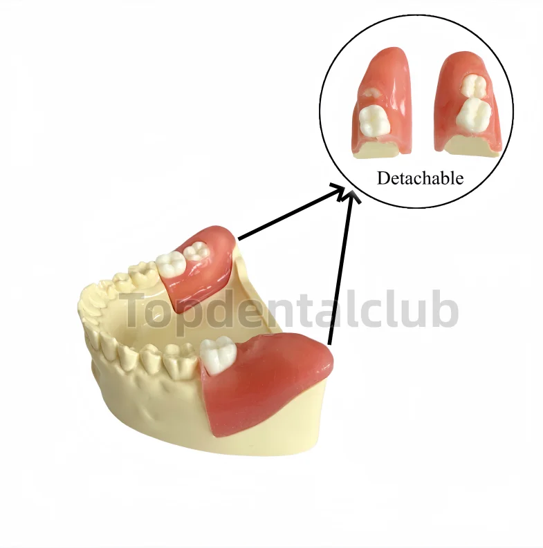 

Учебная модель для удаления врожденно закрытых зубов мудрости с заменяемыми блоками для студентов-стоматологов по оральной хирургии