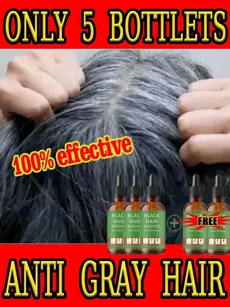 

Anti-grey hair essence Serum treatment restore natural hair color and restore healthy White To Black hair