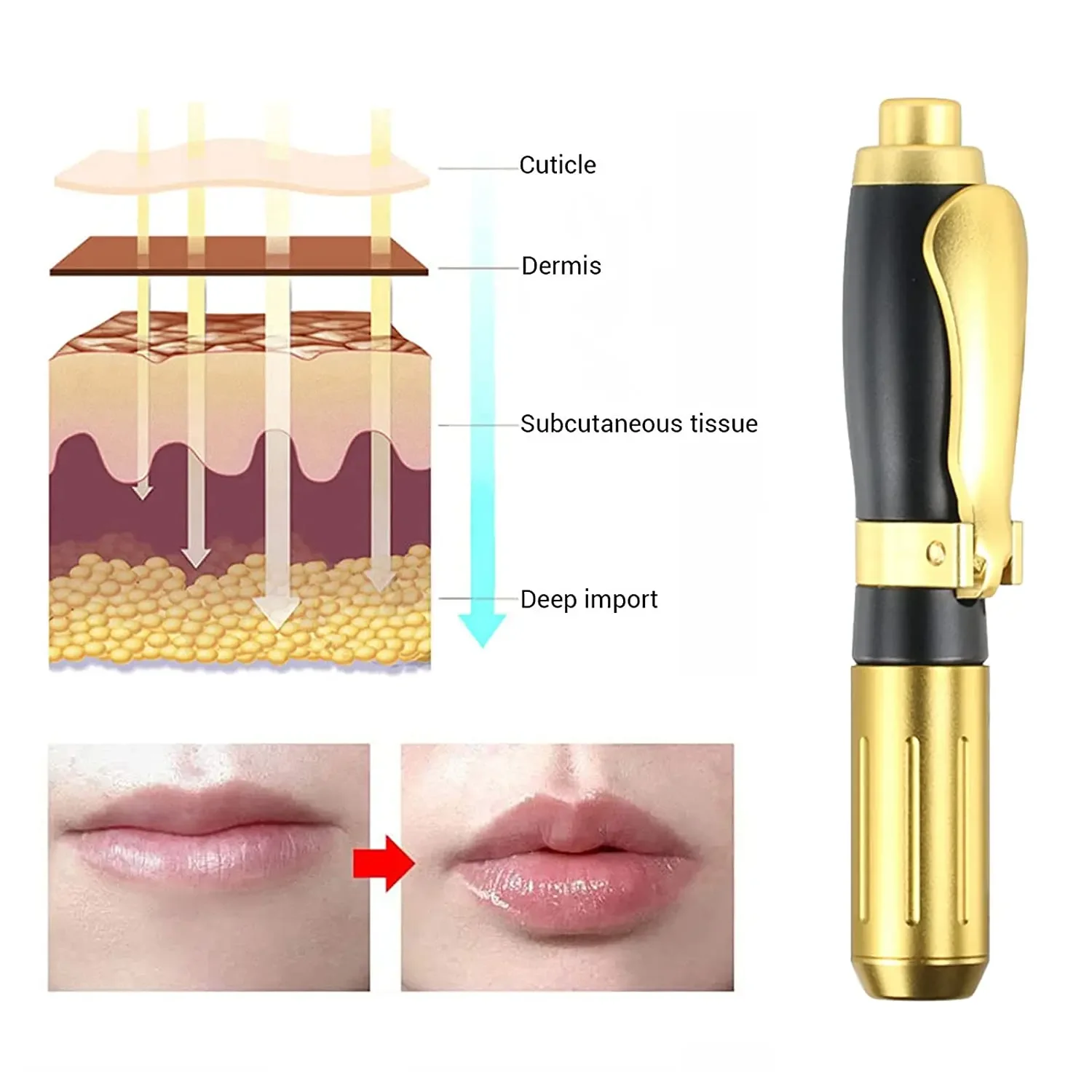 

2-in-1 High-Pressure Hyaluronic Acid Pen with Anti-Wrinkle Lip Injection & Atomizer Features – Beauty Skin Care Tool