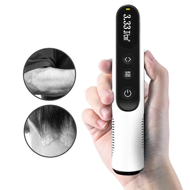 Mini portable psoriasis vitiligo treatment lamp UV 311nm excimer 308nm medium wave UV light emitting diode