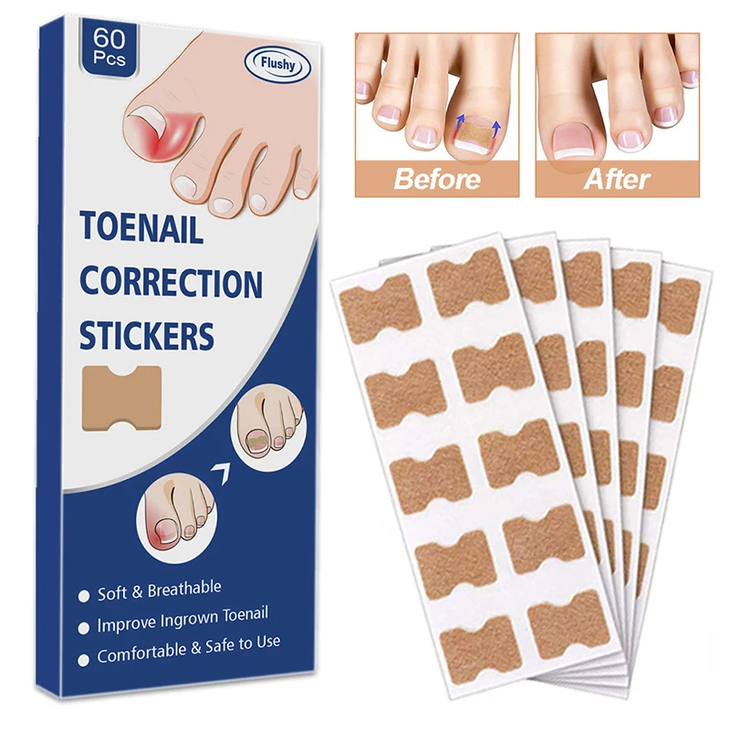 

60Pcs Ingrown Nail Correction Stickers Toenail Corrector Patches Paronychia Treatment Recover Corrector Pedicure Nail Care Tool