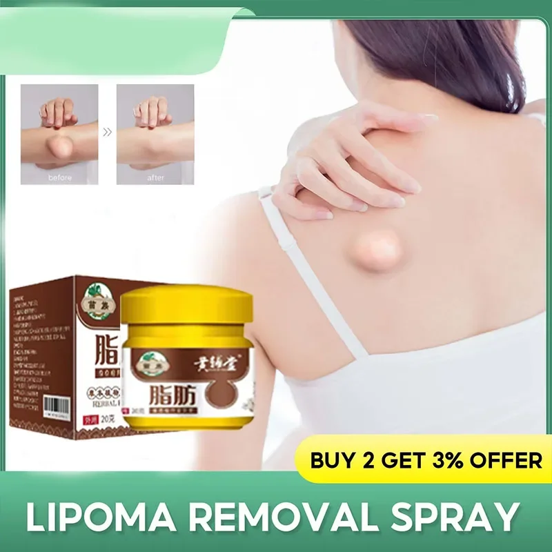 Lipoma Removal Cream Body Cream Dissolving Fat Easy To Use Lipoma Removal Cream