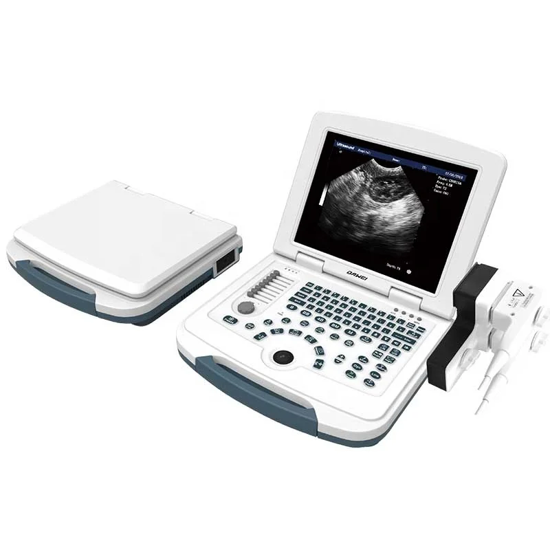 Dawei Portable Veterinary Cat/Horse/Sheep/Cow/Equine Ultrasound Scanner Machine For Clinic