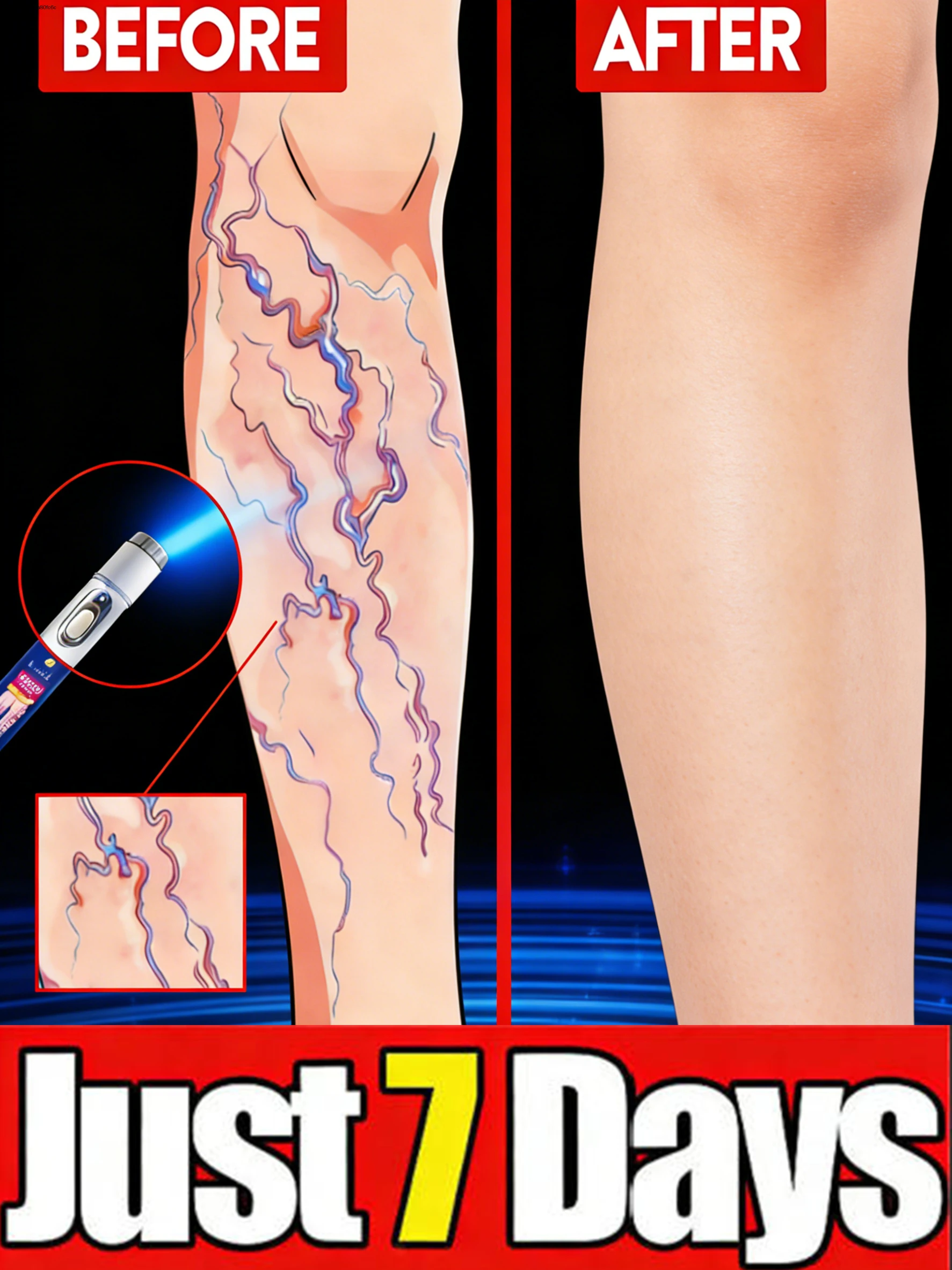 ᴳᵉⁿᵗˡᵉ ᶜᵃʳᵉ ᶠᵒʳ ᴸᵉᵍ ⱽᵉⁱⁿˢ⸴Help Your Legs Look Smoother and More Even