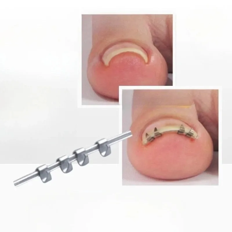 

Nail and groove aligners, fingernail manicure tools