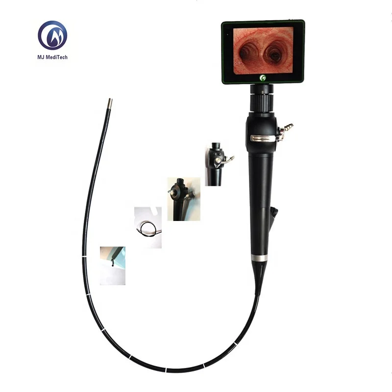 Flexible Video Bronchoscope Use Flexible Video Fiber Bronchoscope/Laryngoscope Price for ICU Difficult Airway Intubation