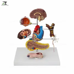 Human Diabetes Pathology Model Teaching Anatomical Model 8 Parts High Quality Pancreas Anatomy Model