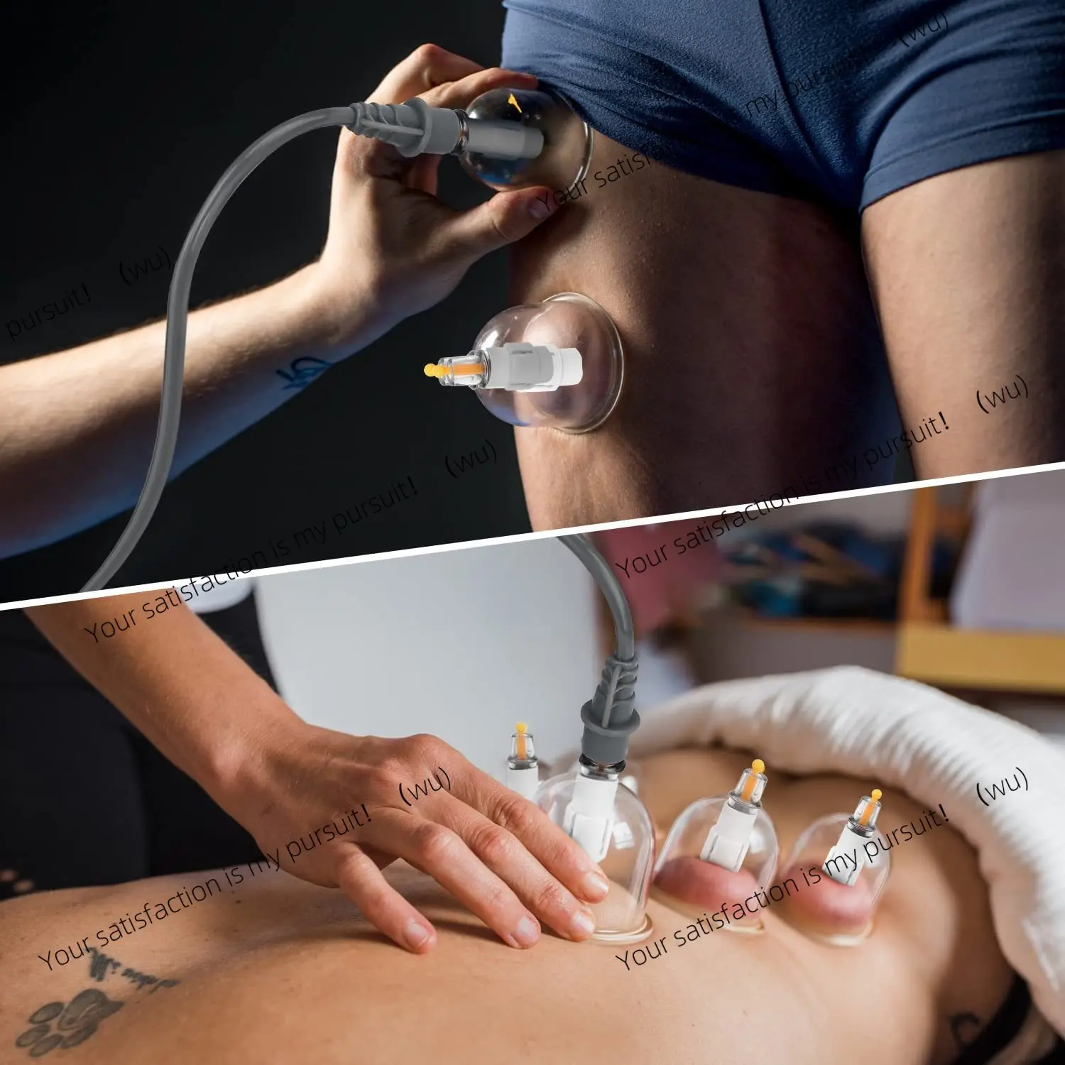 

Cupping physiotherapy set, vacuum suction cup massage physiotherapy tank, body massager