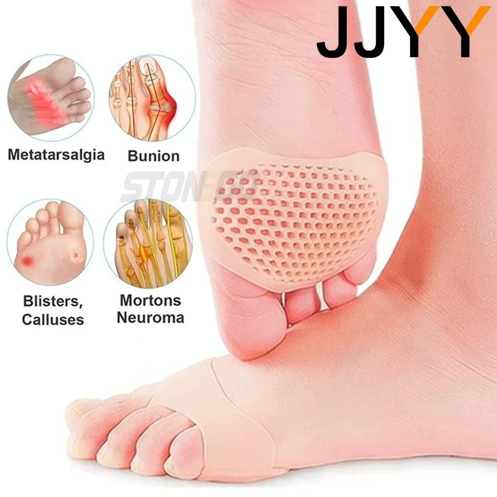 1 Paar weiche Silikon-Vorfußpolster, Wabenkissen, Schmerzlinderung, Bunion-Schutz-Einlegesohlen für Komfort und Unterstützung